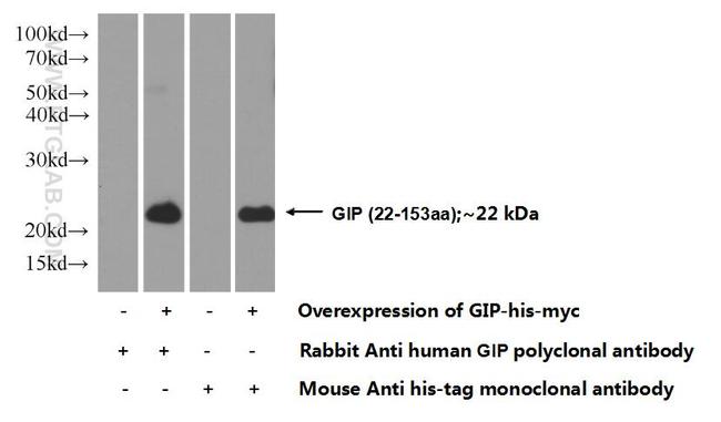 GIP Antibody in Western Blot (WB)