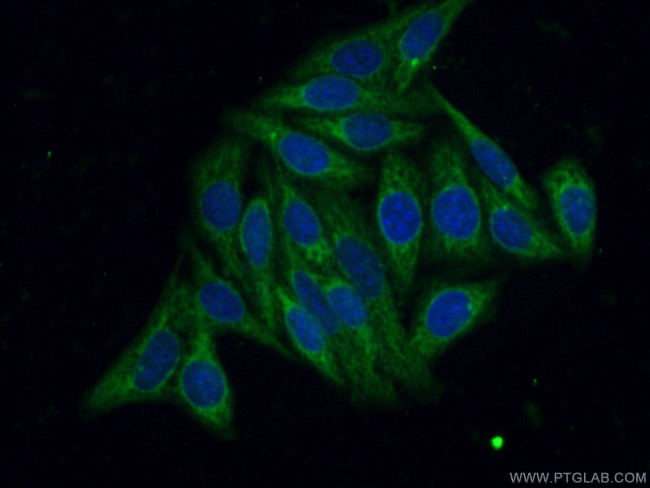 LONP2 Antibody in Immunocytochemistry (ICC/IF)