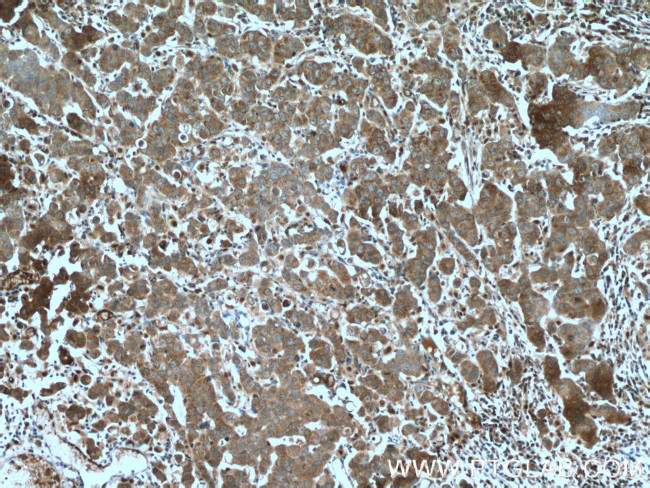 LONP2 Antibody in Immunohistochemistry (Paraffin) (IHC (P))