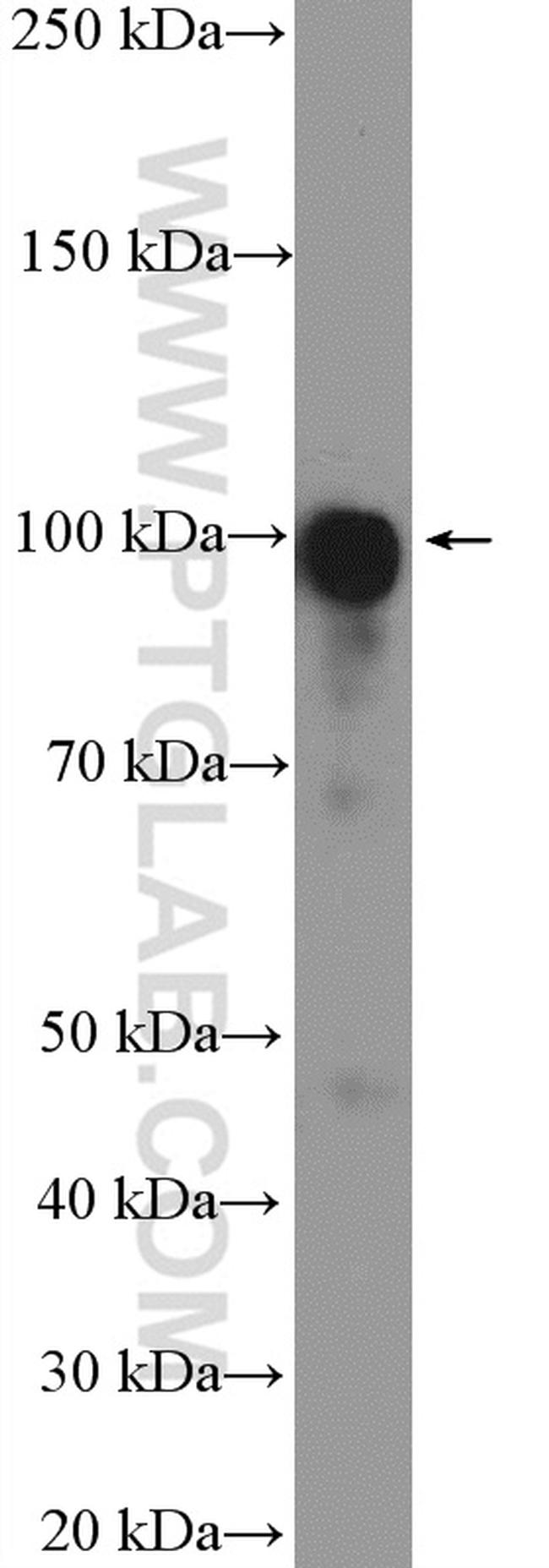 LONP2 Antibody in Western Blot (WB)