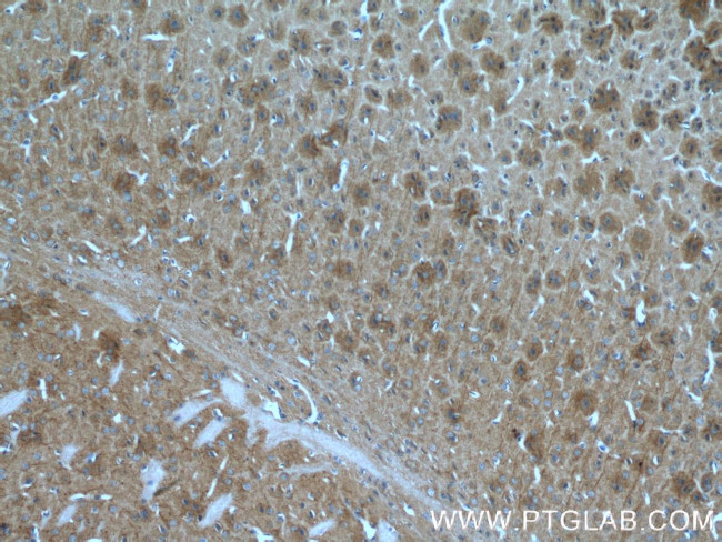 SAP102 Antibody in Immunohistochemistry (Paraffin) (IHC (P))