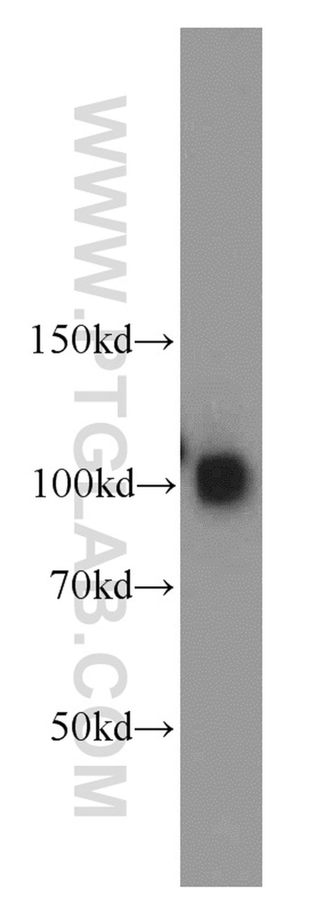 SAP102 Antibody in Western Blot (WB)