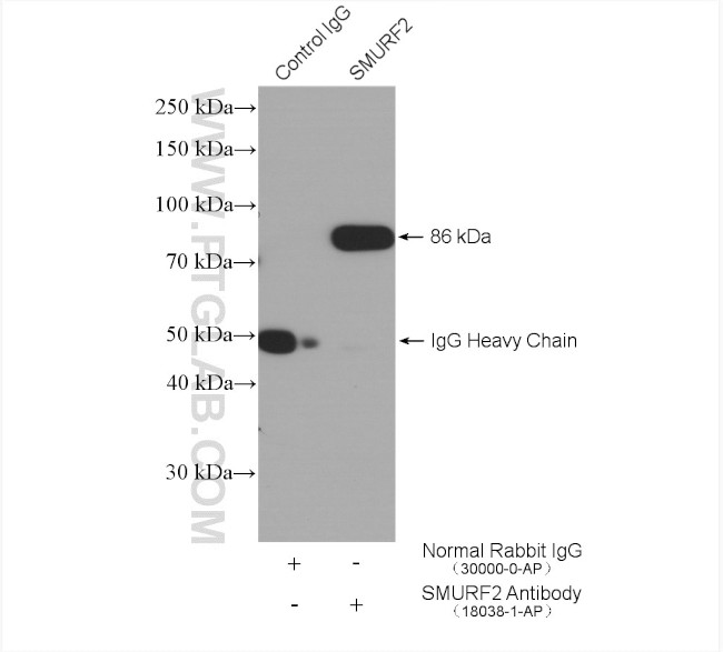 SMURF2 Antibody in Immunoprecipitation (IP)