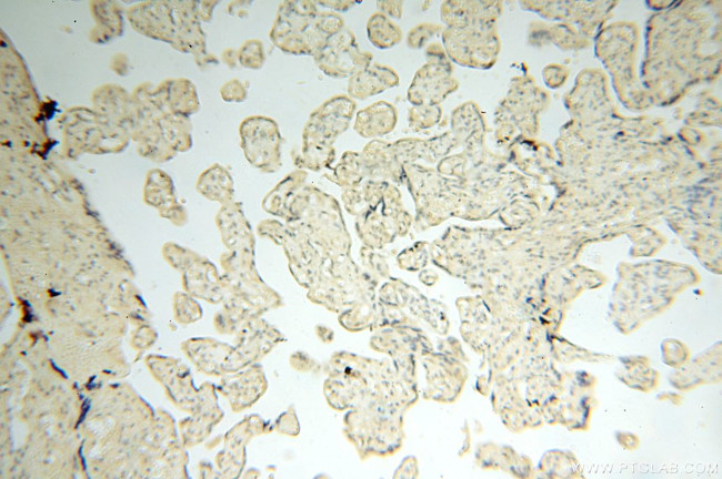 UBA52 Antibody in Immunohistochemistry (Paraffin) (IHC (P))