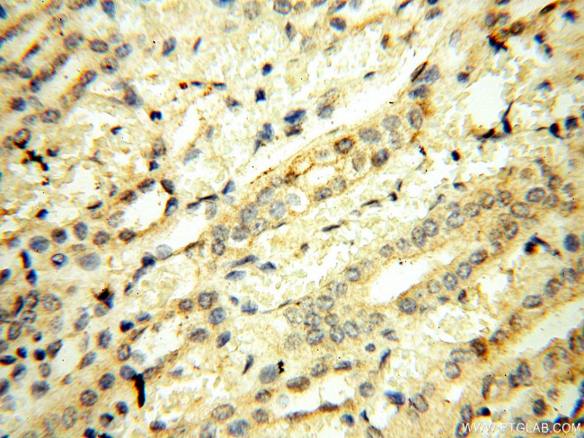 UBA52 Antibody in Immunohistochemistry (Paraffin) (IHC (P))