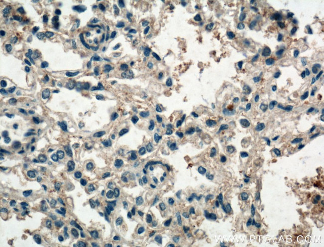 IL36 Beta/IL1F8 Antibody in Immunohistochemistry (Paraffin) (IHC (P))