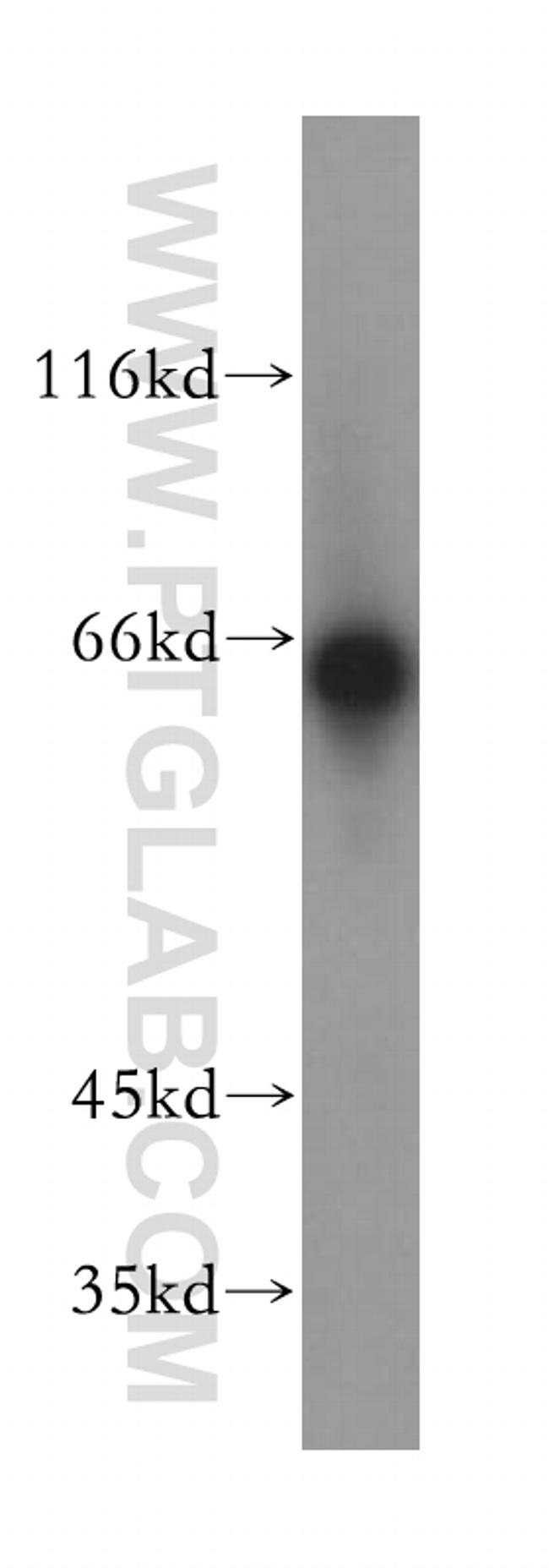 LGI2 Antibody in Western Blot (WB)