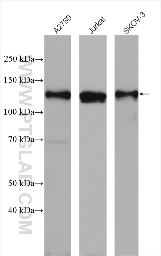 MLN51/CASC3 Antibody in Western Blot (WB)