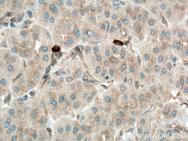 MLN51/CASC3 Antibody in Immunohistochemistry (Paraffin) (IHC (P))
