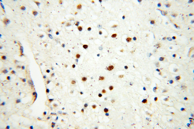 DNA Ligase I Antibody in Immunohistochemistry (Paraffin) (IHC (P))