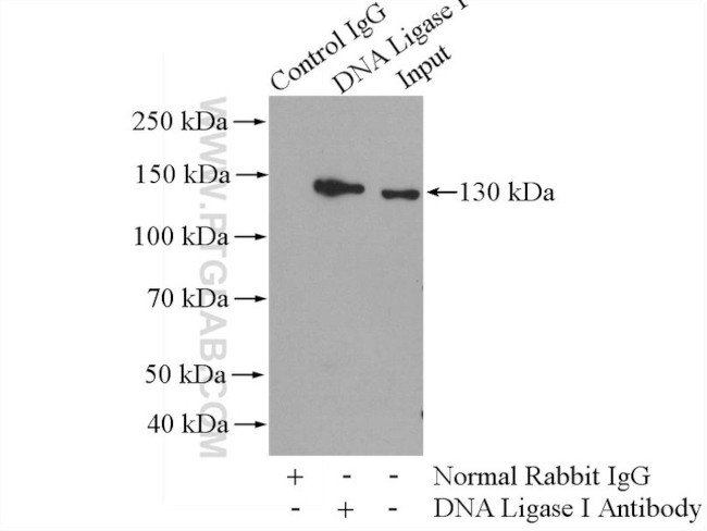 DNA Ligase I Antibody in Immunoprecipitation (IP)