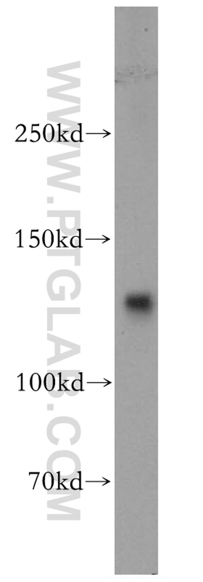 DNA Ligase I Antibody in Western Blot (WB)