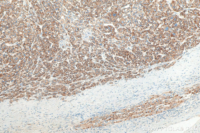 fetuin-B Antibody in Immunohistochemistry (Paraffin) (IHC (P))