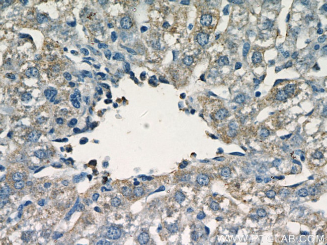 fetuin-B Antibody in Immunohistochemistry (Paraffin) (IHC (P))