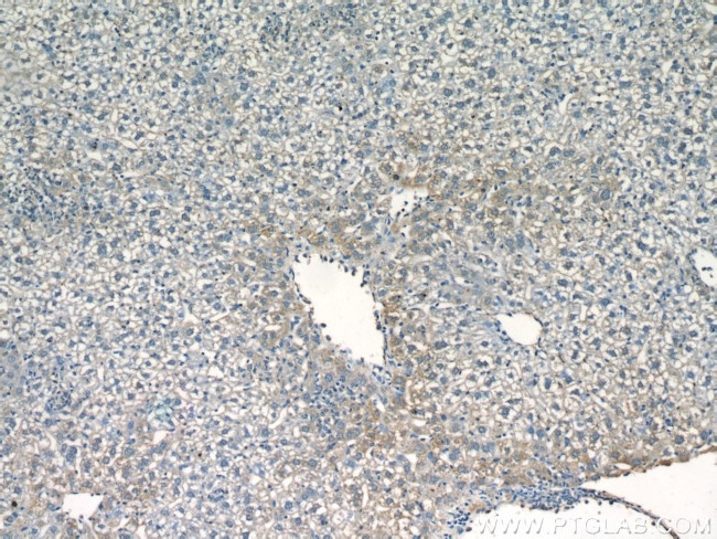 fetuin-B Antibody in Immunohistochemistry (Paraffin) (IHC (P))