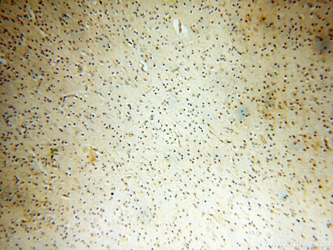 PTPN14 Antibody in Immunohistochemistry (Paraffin) (IHC (P))