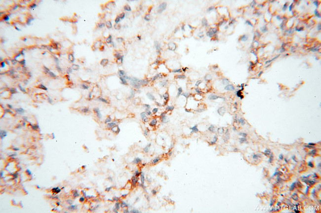 PTPN14 Antibody in Immunohistochemistry (Paraffin) (IHC (P))