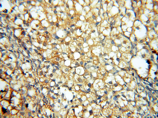 PTPN14 Antibody in Immunohistochemistry (Paraffin) (IHC (P))