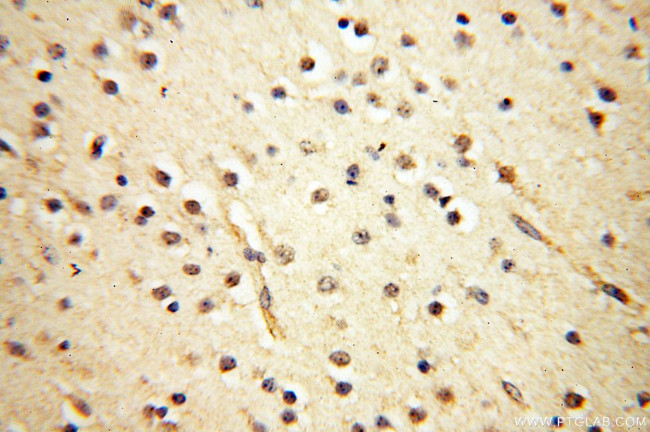 PTPN14 Antibody in Immunohistochemistry (Paraffin) (IHC (P))