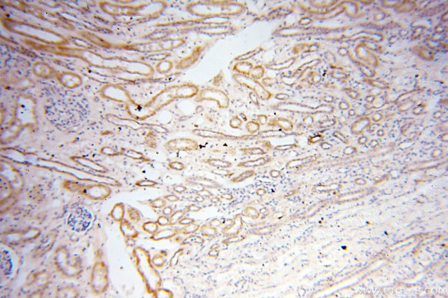 PTPN14 Antibody in Immunohistochemistry (Paraffin) (IHC (P))