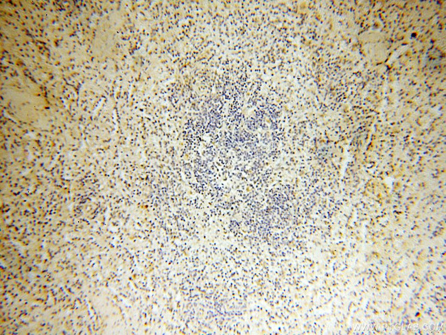 PTPN14 Antibody in Immunohistochemistry (Paraffin) (IHC (P))