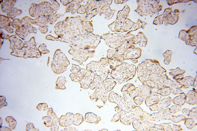 PTPN14 Antibody in Immunohistochemistry (Paraffin) (IHC (P))