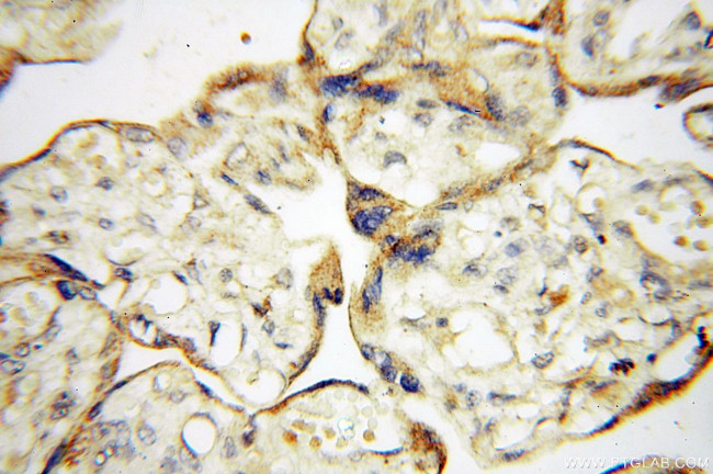 PTPN14 Antibody in Immunohistochemistry (Paraffin) (IHC (P))