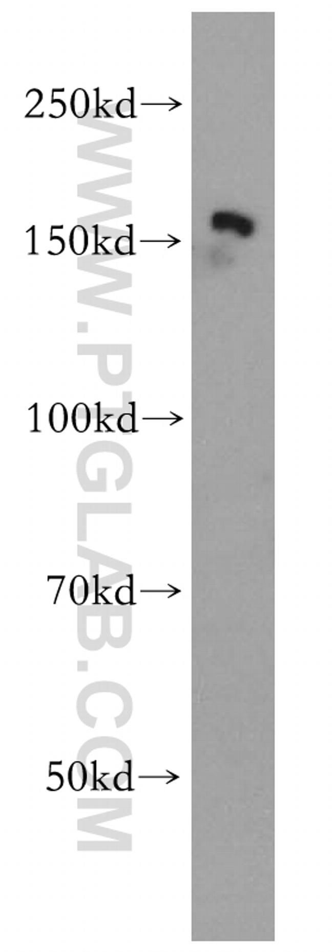 PTPN14 Antibody in Western Blot (WB)