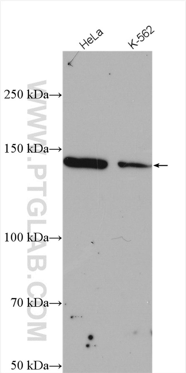 PTPN14 Antibody in Western Blot (WB)