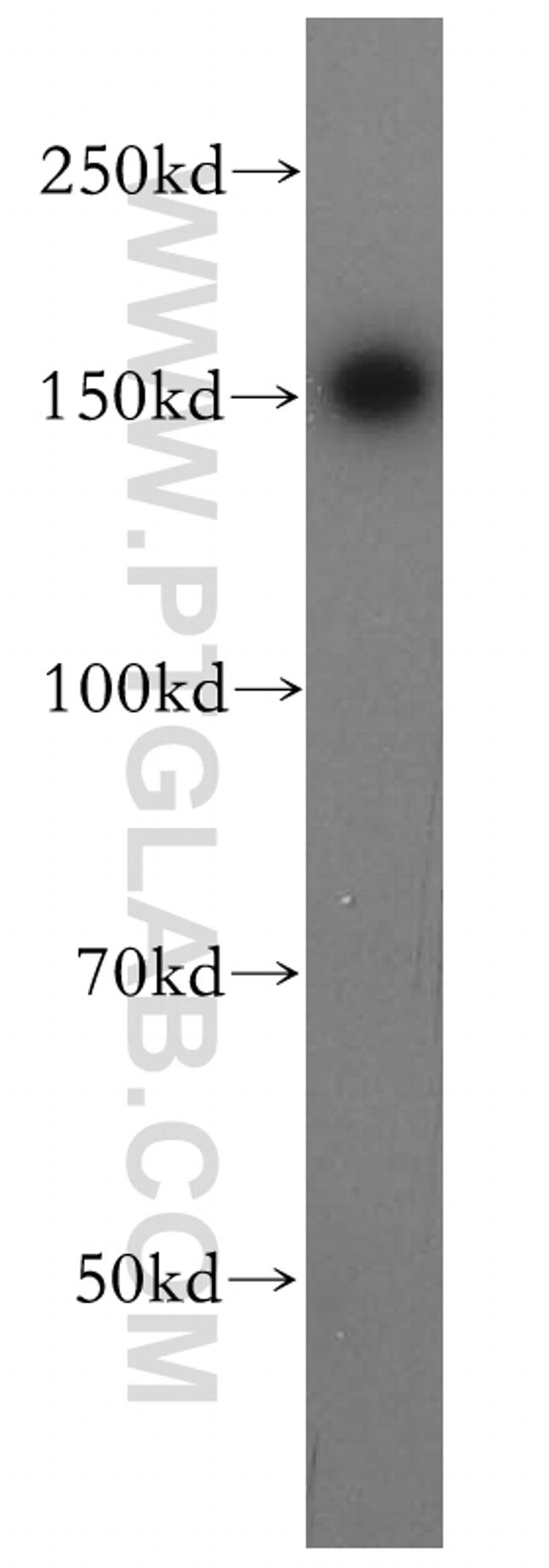 PTPN14 Antibody in Western Blot (WB)