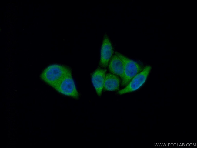 DEFA1 Antibody in Immunocytochemistry (ICC/IF)