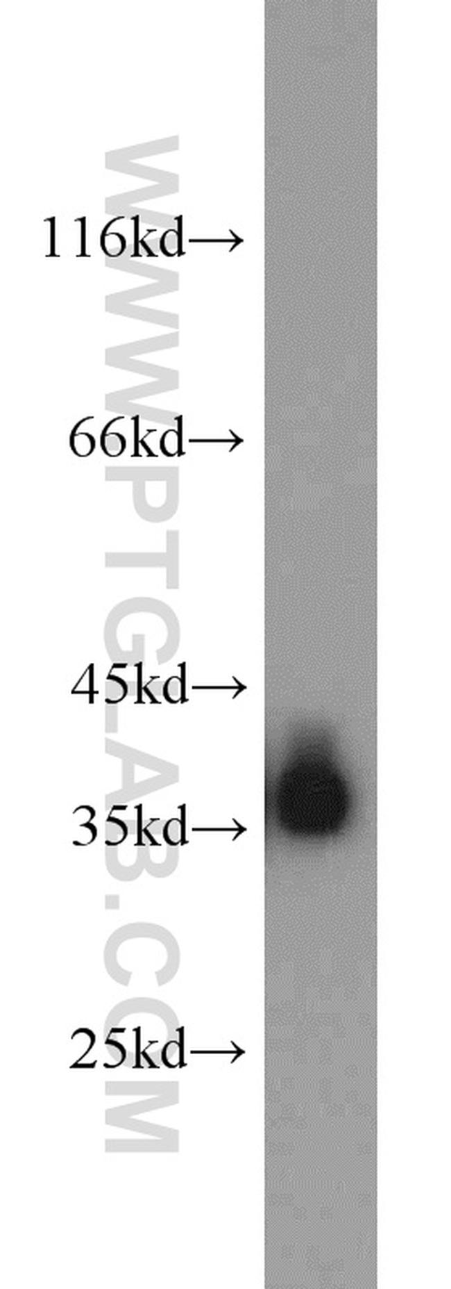 ALDOB Antibody in Western Blot (WB)