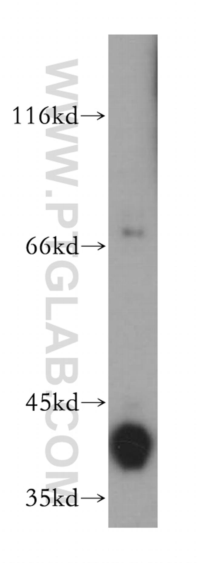 ALDOB Antibody in Western Blot (WB)