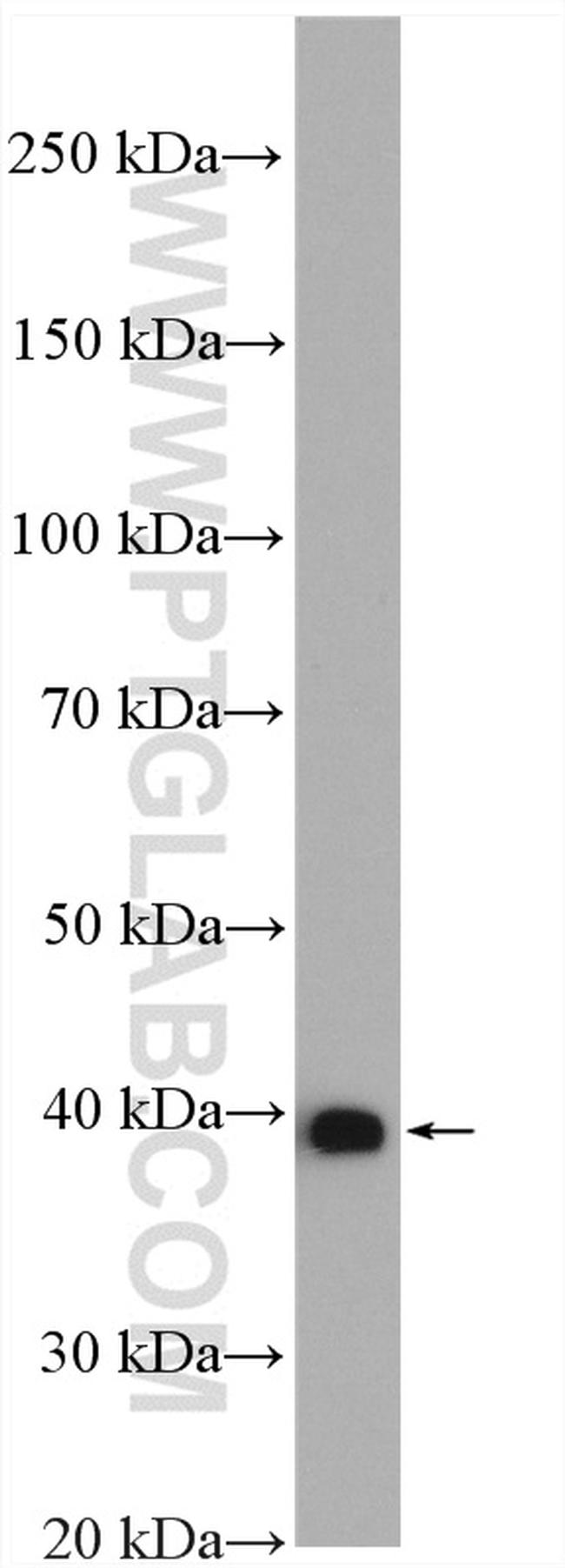 ALDOB Antibody in Western Blot (WB)