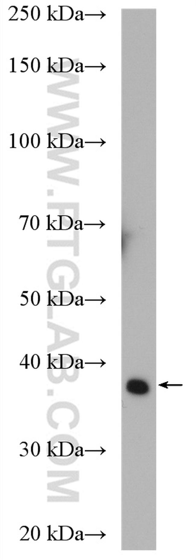 ALDOB Antibody in Western Blot (WB)