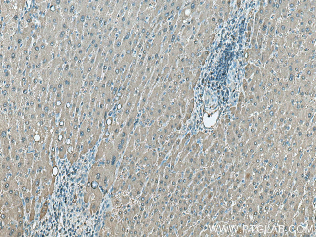 ALDOB Antibody in Immunohistochemistry (Paraffin) (IHC (P))