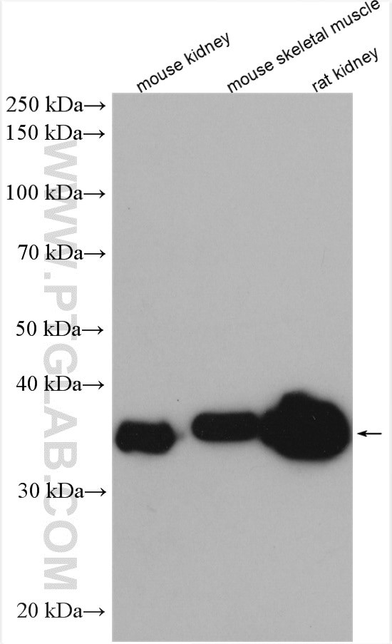 ALDOB Antibody in Western Blot (WB)