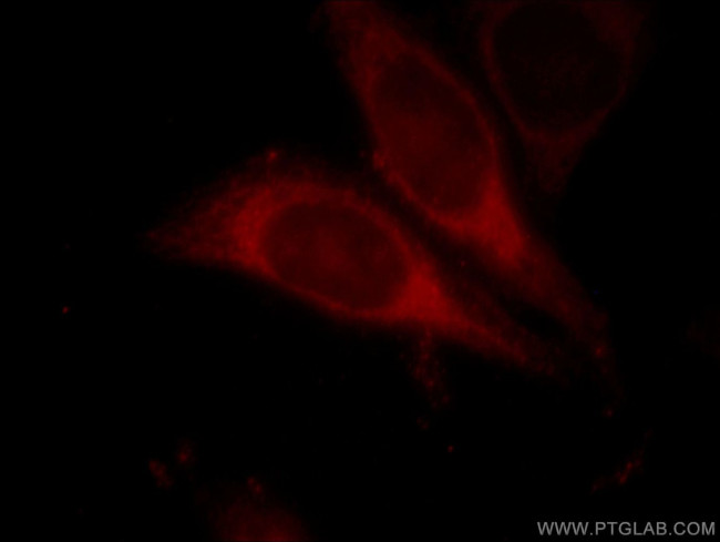 ALDOB Antibody in Immunocytochemistry (ICC/IF)