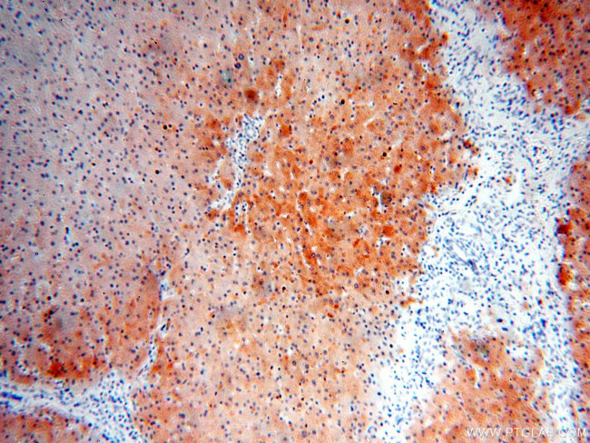 ALDOB Antibody in Immunohistochemistry (Paraffin) (IHC (P))