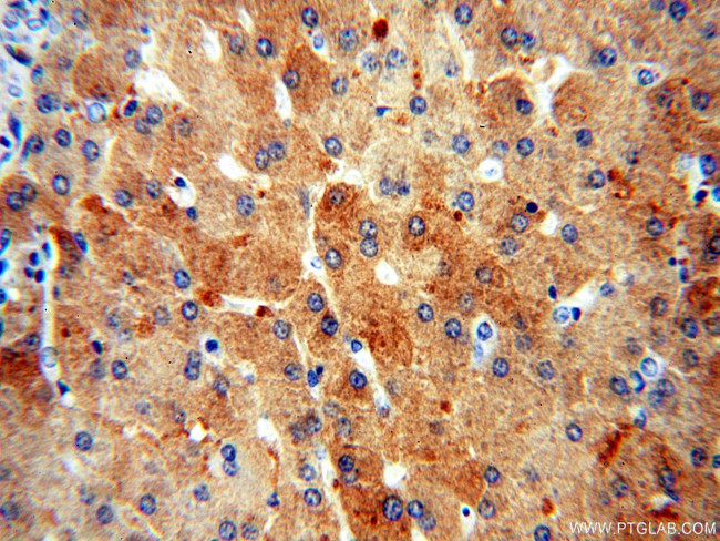 ALDOB Antibody in Immunohistochemistry (Paraffin) (IHC (P))