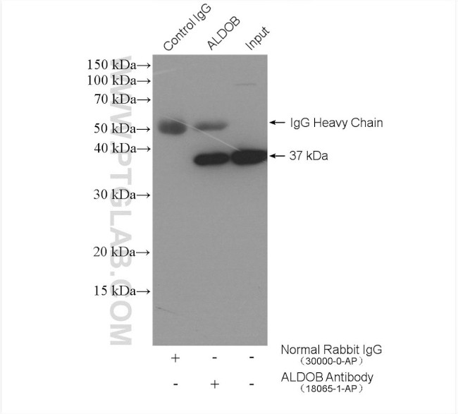 ALDOB Antibody in Immunoprecipitation (IP)