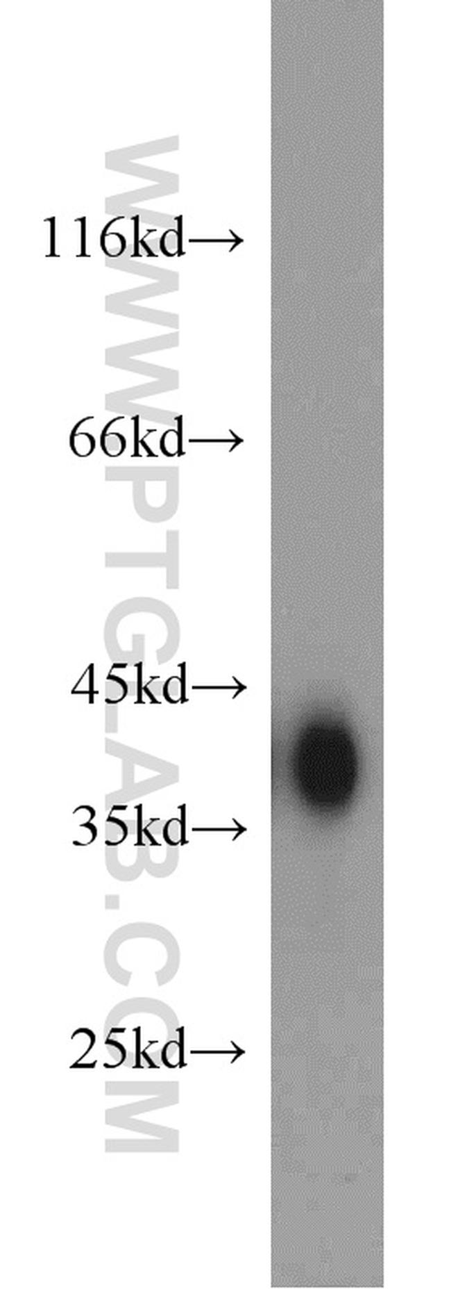 ALDOB Antibody in Western Blot (WB)