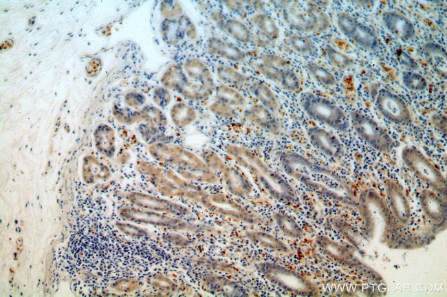 USP49 Antibody in Immunohistochemistry (Paraffin) (IHC (P))