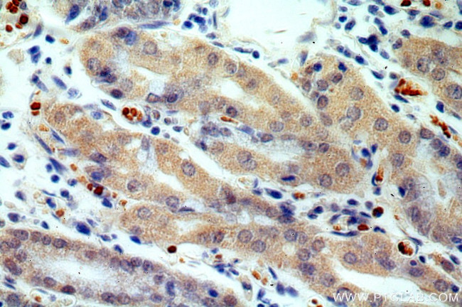 USP49 Antibody in Immunohistochemistry (Paraffin) (IHC (P))