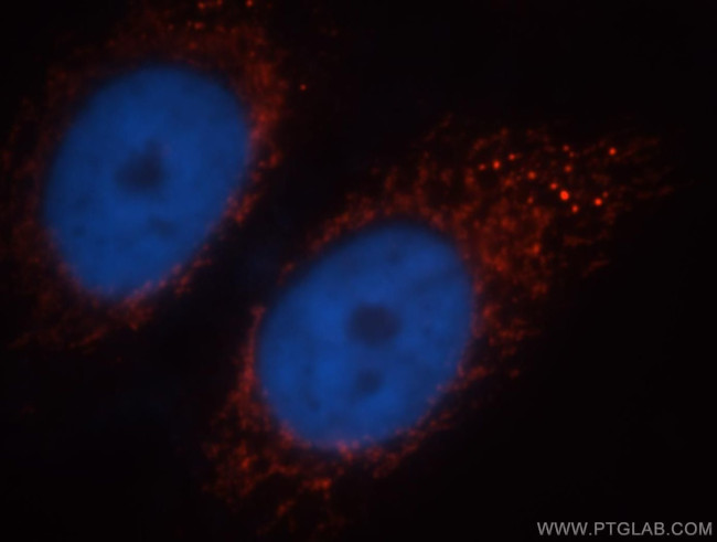 PDH E1 alpha Antibody in Immunocytochemistry (ICC/IF)