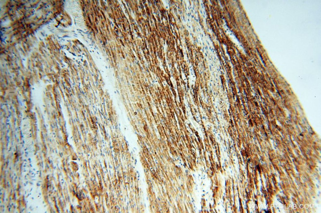 PDH E1 alpha Antibody in Immunohistochemistry (Paraffin) (IHC (P))