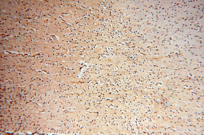 PDH E1 alpha Antibody in Immunohistochemistry (Paraffin) (IHC (P))