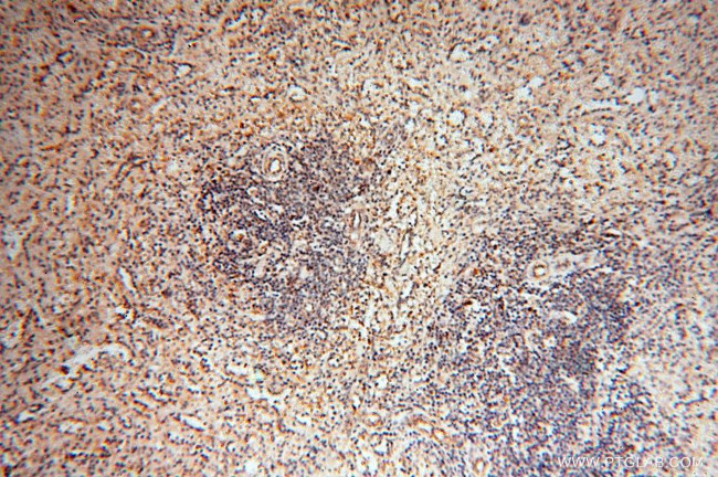 PDH E1 alpha Antibody in Immunohistochemistry (Paraffin) (IHC (P))