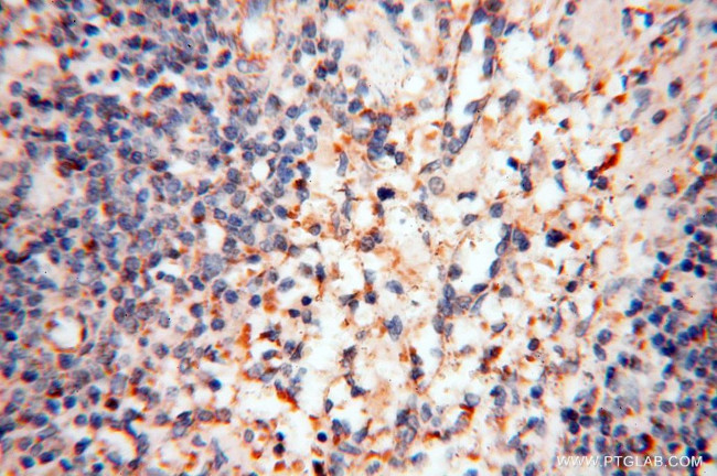 PDH E1 alpha Antibody in Immunohistochemistry (Paraffin) (IHC (P))