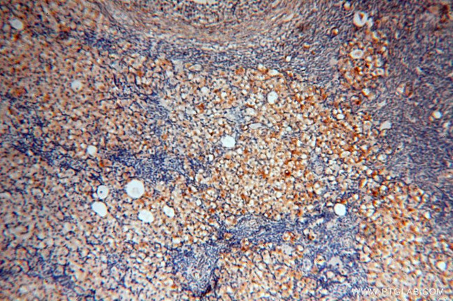 PDH E1 alpha Antibody in Immunohistochemistry (Paraffin) (IHC (P))